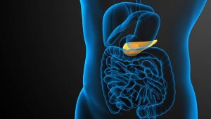 Gallbladder Surgery