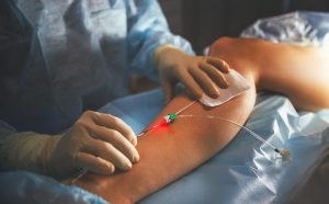 Varicose Surgery